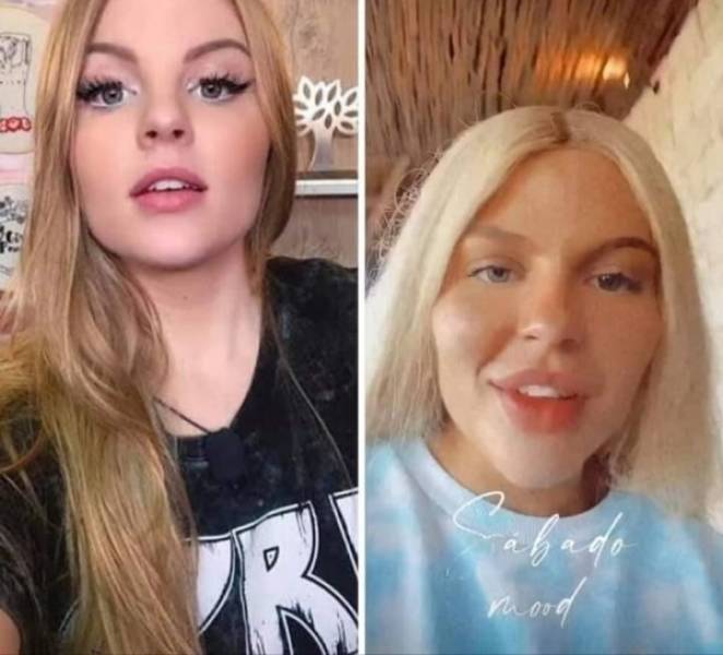 Plastic Surgery Is DEFINITELY Not For Everyone…