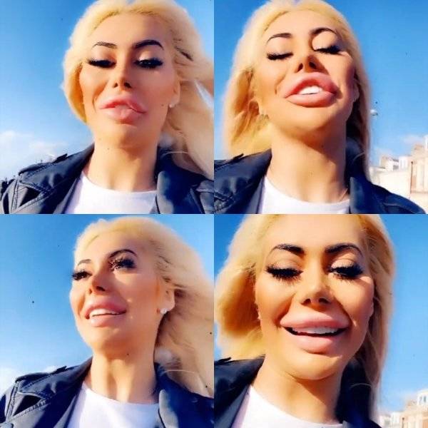 Plastic Surgery Is DEFINITELY Not For Everyone…