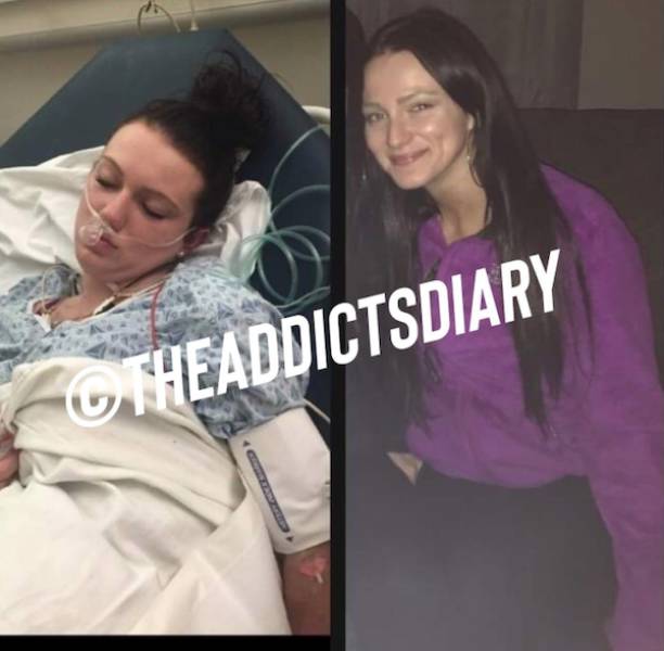 Incredibly Inspiring Drug Addict Transformations!