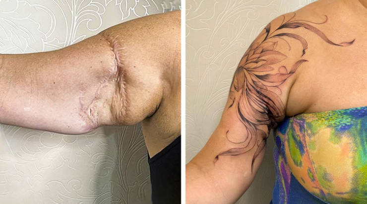 Artist Saves People’s Scars By Tattooing Over Them