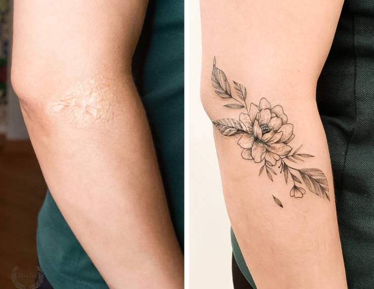 Artist Saves People’s Scars By Tattooing Over Them