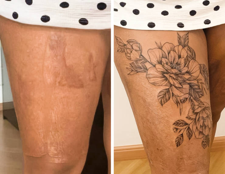 Artist Saves People’s Scars By Tattooing Over Them