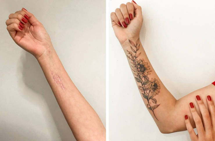 Artist Saves People’s Scars By Tattooing Over Them