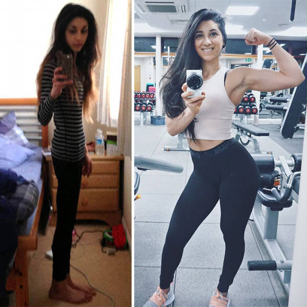 Anorexia Is Not The Final Verdict!