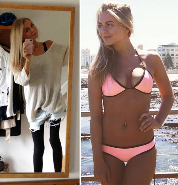 Anorexia Is Not The Final Verdict!