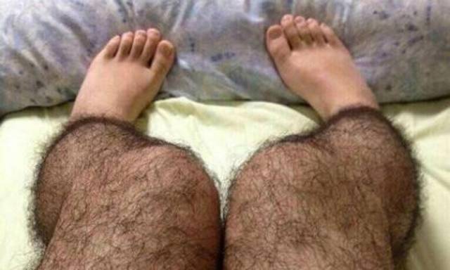 Some Trendy Clothes Should Just Go Away!