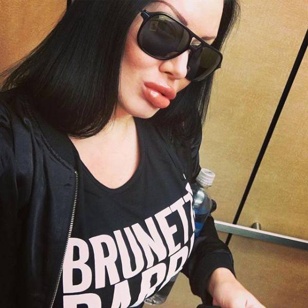 For Them, Lips Are Never Big Enough…