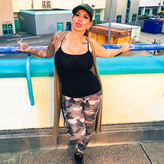 For Them, Lips Are Never Big Enough…