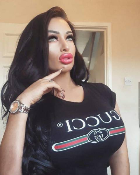 For Them, Lips Are Never Big Enough…