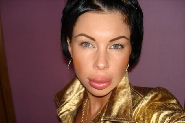 Girls with silicone faces (37 pics)