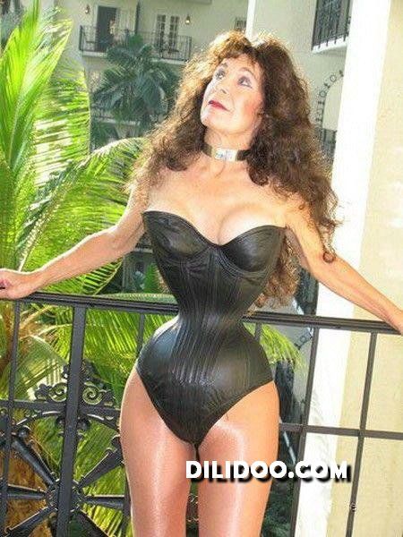 When plastic surgery fails (38 pics)