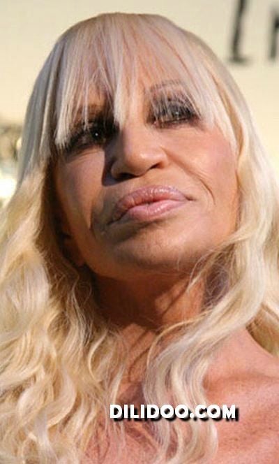 When plastic surgery fails (38 pics)