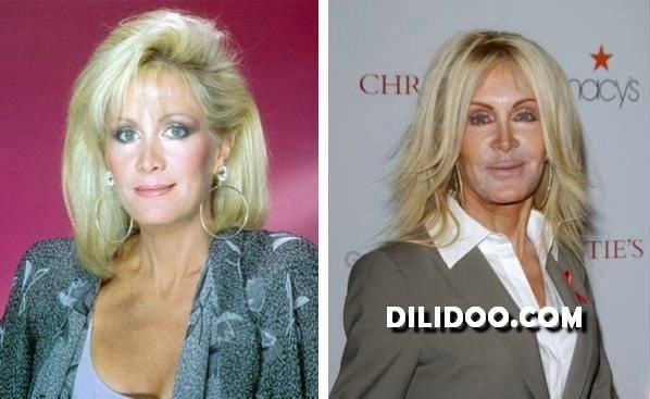 When plastic surgery fails (38 pics)