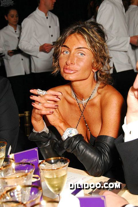 When plastic surgery fails (38 pics)