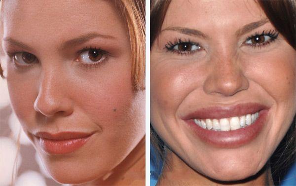 When plastic surgery fails (38 pics)