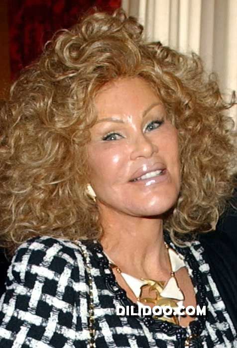 When plastic surgery fails (38 pics)