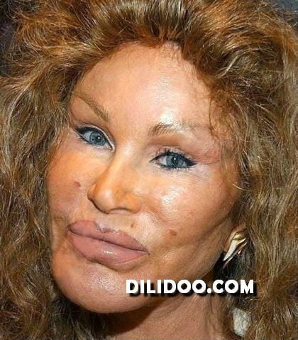 When plastic surgery fails (38 pics)