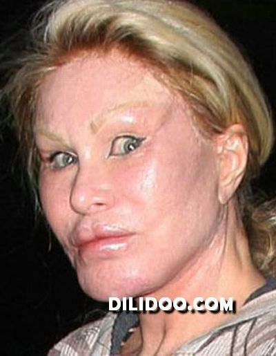 When plastic surgery fails (38 pics)