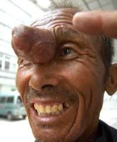 Curiosities and bonus pictures