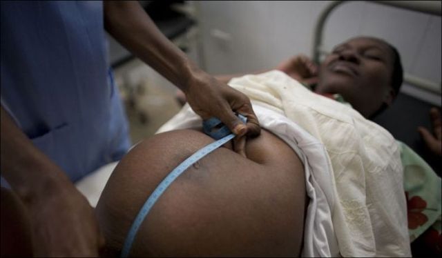 Giving birth in Haiti (15 pics)