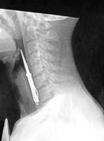 Curiosities and bonus pictures