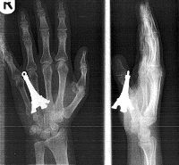 Curiosities and bonus pictures