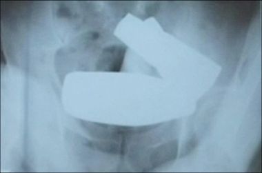 Curiosities and bonus pictures