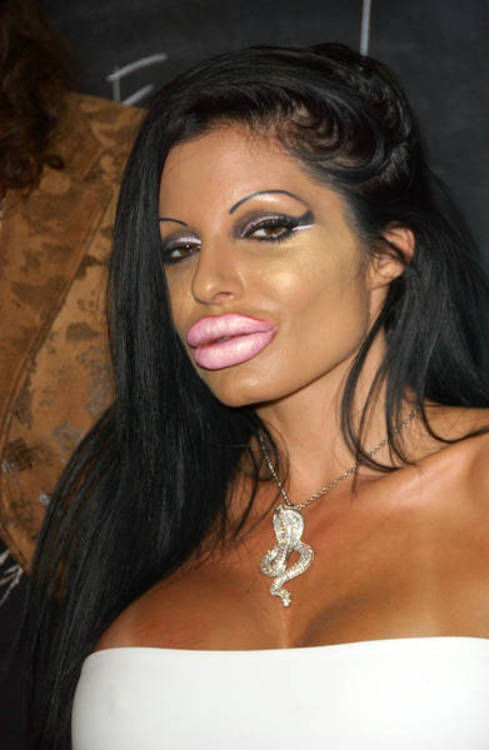 “Monster” Smile (16 pics)