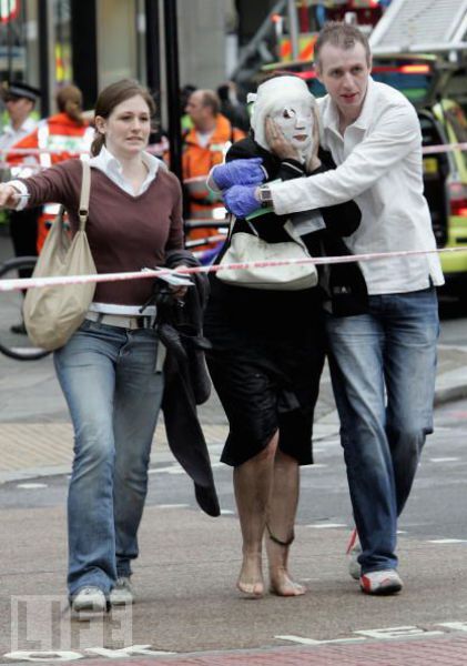 Incredible Healing after a Bomb Explosion (15 pics) Incredible Healing after a Bomb Explosion (15 pics)