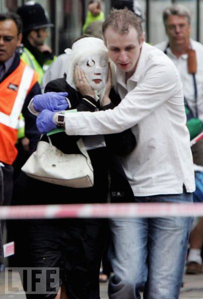 Incredible Healing after a Bomb Explosion (15 pics) Incredible Healing after a Bomb Explosion (15 pics)