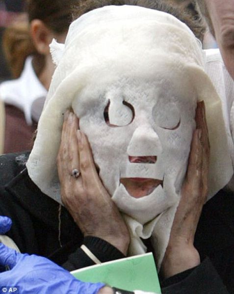 Incredible Healing after a Bomb Explosion (15 pics) Incredible Healing after a Bomb Explosion (15 pics)