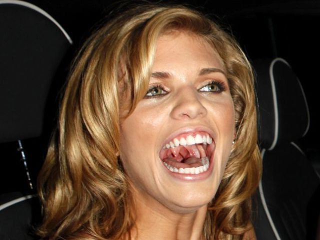 Celebrities Aren’t Perfect (31 pics) Celebrities Aren’t Perfect (31 pics)