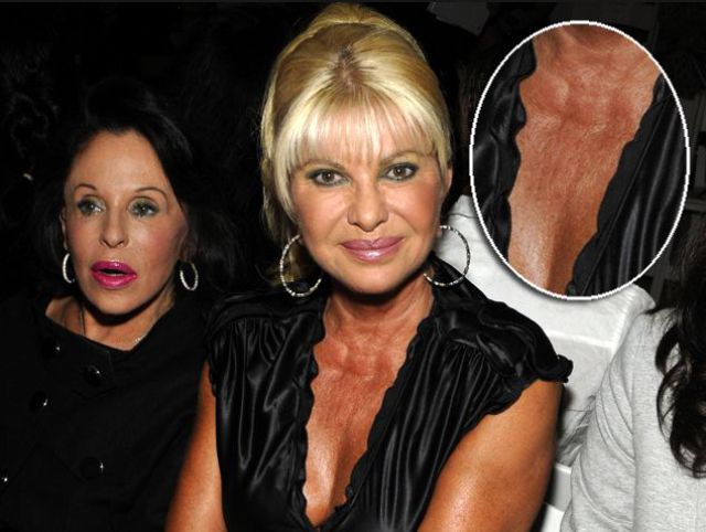 Celebrities Aren’t Perfect (31 pics) Celebrities Aren’t Perfect (31 pics)