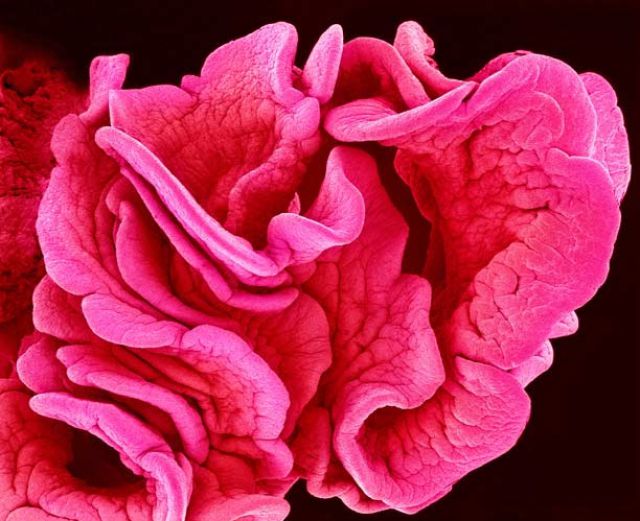 Amazing Scanning Electron Microscope Pictures