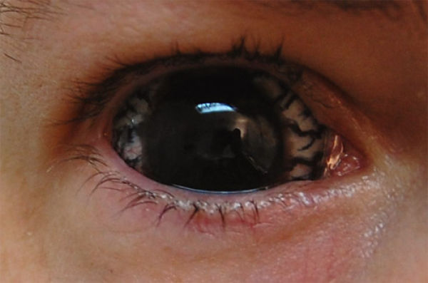 Eerie Eyeball Covers