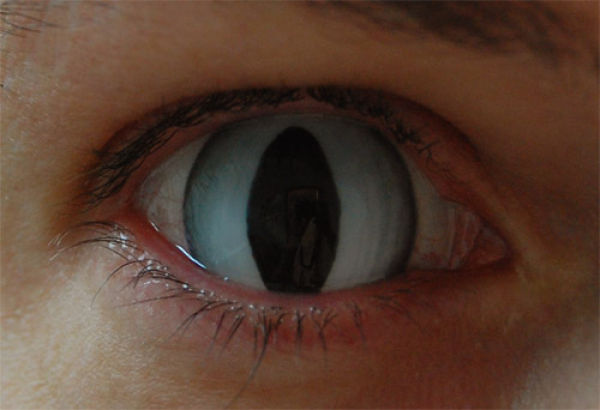 Eerie Eyeball Covers