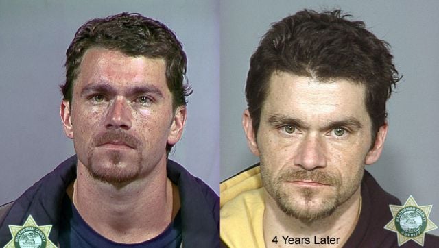 Meth Addicts: Before and After
