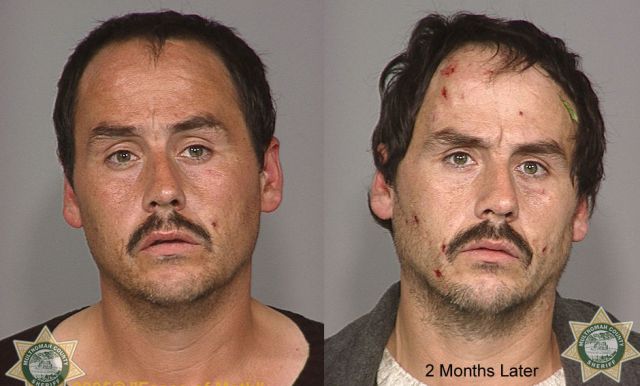 Meth Addicts: Before and After