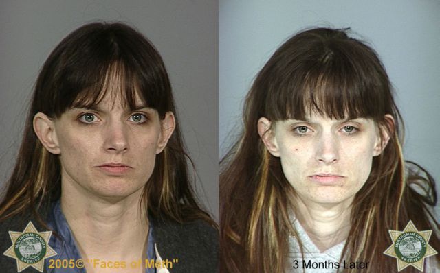 Meth Addicts: Before and After