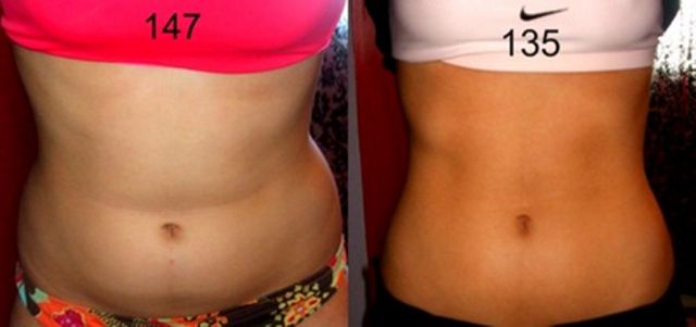 Once Chubby, Now Thin