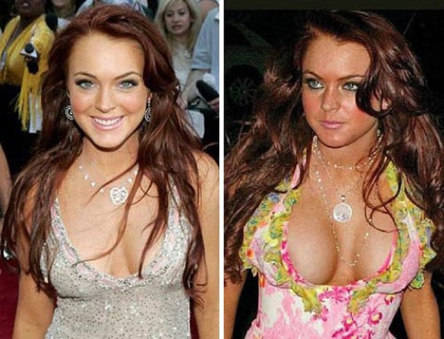 Celebs with the Worst Fake Breasts: Before and After