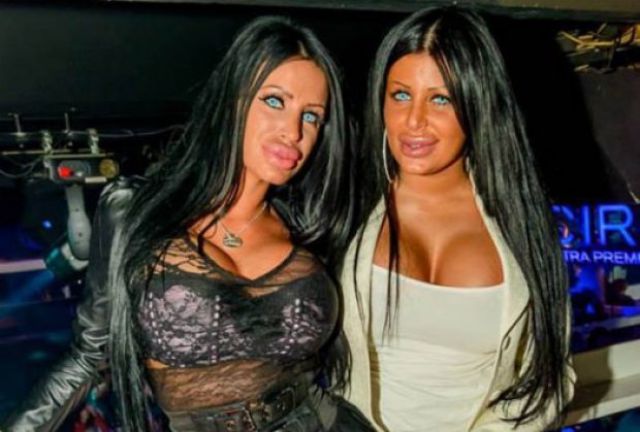 Queens of Disastrous Plastic Surgeries