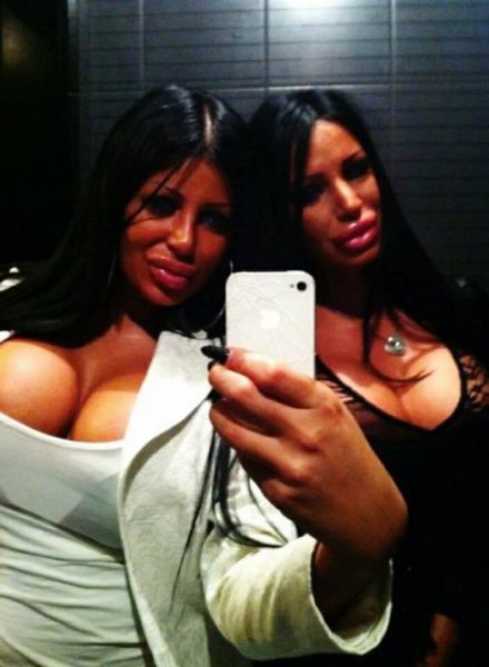 Queens of Disastrous Plastic Surgeries