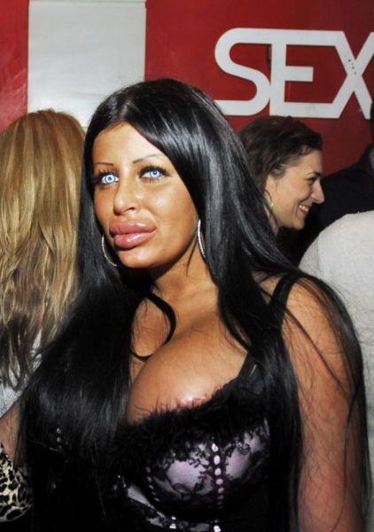 Queens of Disastrous Plastic Surgeries