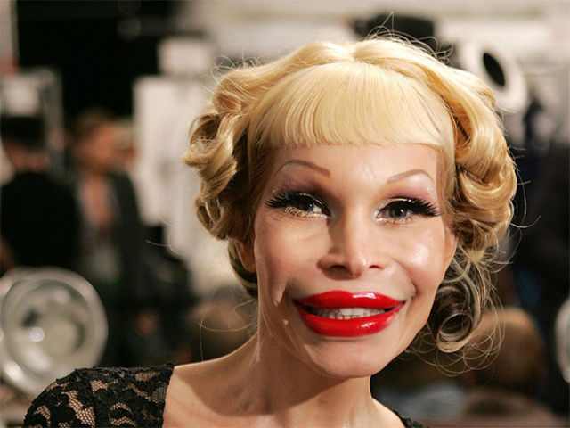 Plastic Surgery Fails That Are Just Wrong