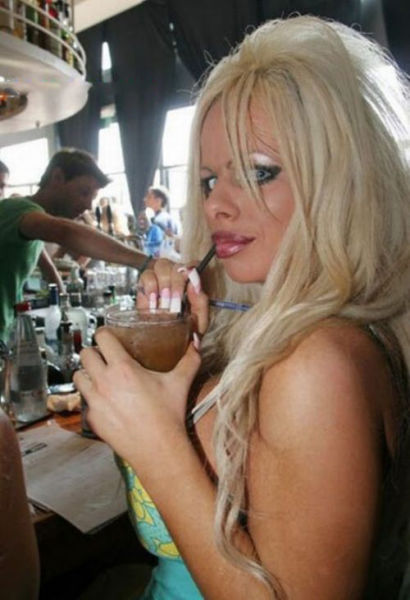 Plastic Surgery Fails That Are Just Wrong