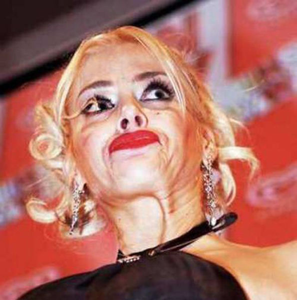Plastic Surgery Fails That Are Just Wrong