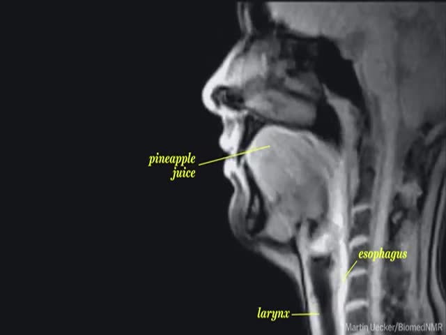 What Life Looks like Through an MRI Machine 